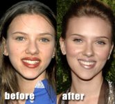 lips_nose_scarjo.jpg