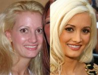 holly_madison_before_after.jpg