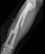 arm4.jpg