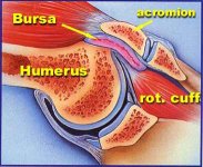 impingement.jpg