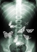 butterflies_in_my_stomach_by_bee_ee_110956889.jpg